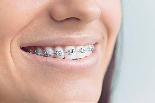 Best Traditional Braces  in Rainsville, AL